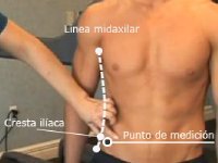 pliegue suprailiaco y somatotipo